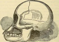An illustration from Human science or phrenology. Its principles, proofs, faculties, organs, temperaments, combinations, conditions, teachings, philosophies, etc., etc. as applied to health. Its value, laws, functions, organs, means, preservation, restoration, etc. Mental philosophy, human and self improvement, civilization, home country, commerce rights, duties, ethics, etc. God, His existence, attributes, laws, worship, natural theology, etc. Immortality, its evidences, conditions, relations to time, rewards, punishments, sin, faith, prayer, etc. Intellect, memory, juvenile and self education, literature, mental discipline, the senses, sciences, arts, avocations, a perfect life, etc., etc (1880)