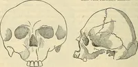 An illustration from Human science or phrenology. Its principles, proofs, faculties, organs, temperaments, combinations, conditions, teachings, philosophies, etc., etc. as applied to health. Its value, laws, functions, organs, means, preservation, restoration, etc. Mental philosophy, human and self improvement, civilization, home country, commerce rights, duties, ethics, etc. God, His existence, attributes, laws, worship, natural theology, etc. Immortality, its evidences, conditions, relations to time, rewards, punishments, sin, faith, prayer, etc. Intellect, memory, juvenile and self education, literature, mental discipline, the senses, sciences, arts, avocations, a perfect life, etc., etc (1880)