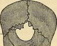 An illustration from Human science or phrenology. Its principles, proofs, faculties, organs, temperaments, combinations, conditions, teachings, philosophies, etc., etc. as applied to health. Its value, laws, functions, organs, means, preservation, restoration, etc. Mental philosophy, human and self improvement, civilization, home country, commerce rights, duties, ethics, etc. God, His existence, attributes, laws, worship, natural theology, etc. Immortality, its evidences, conditions, relations to time, rewards, punishments, sin, faith, prayer, etc. Intellect, memory, juvenile and self education, literature, mental discipline, the senses, sciences, arts, avocations, a perfect life, etc., etc (1880)
