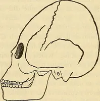 An illustration from Human science or phrenology. Its principles, proofs, faculties, organs, temperaments, combinations, conditions, teachings, philosophies, etc., etc. as applied to health. Its value, laws, functions, organs, means, preservation, restoration, etc. Mental philosophy, human and self improvement, civilization, home country, commerce rights, duties, ethics, etc. God, His existence, attributes, laws, worship, natural theology, etc. Immortality, its evidences, conditions, relations to time, rewards, punishments, sin, faith, prayer, etc. Intellect, memory, juvenile and self education, literature, mental discipline, the senses, sciences, arts, avocations, a perfect life, etc., etc (1880)