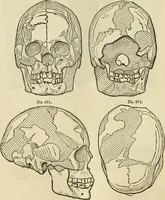 An illustration from Ilios; the city and country of the Trojans. The results of researches and discoveries on the site of Troy and throughout the Troad in the years 1871-72-73-78-79, including an autobiography of the author (1880)