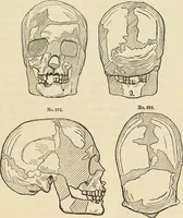 An illustration from Ilios; the city and country of the Trojans. The results of researches and discoveries on the site of Troy and throughout the Troad in the years 1871-72-73-78-79, including an autobiography of the author (1880)
