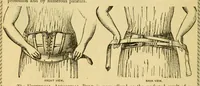 An illustration from Illustrated catalogue .. (1891)