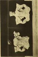 An illustration from Illustrated catalogue of classical antiquities from the site of the temple of Diana, Nemi, Italy. Discovered during excavations undertaken by the Right Hon. Lord Savile ... and given by him to the Art museum of Nottingham: with an account by Lord Savile of the discovery of the temple and the objects foundthere (1893)