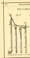 An illustration from Illustrated instruction book for the Bickford family knitting machine (1873)