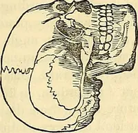 An illustration from Indigenous races of the earth; (1857)