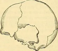 An illustration from Indigenous races of the earth; (1857)