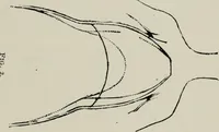 An illustration from The influence of dress in producing the physical decadence of American women : annual address upon obstetrics and gynecology (1891)