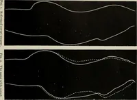 An illustration from The influence of dress in producing the physical decadence of American women : annual address upon obstetrics and gynecology (1891)