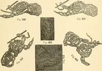 An illustration from The international encyclopedia of scientific tailor principles, for all kinds and styles of garment-making ... Also designing ... embroidery, crocheting, knitting, worsted work, fancy and artistic needle work .. (1885)