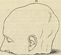 An illustration from An introduction to phrenology (1837)