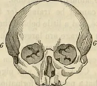 An illustration from An introduction to phrenology (1837)