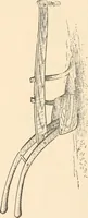 An illustration from The inventors and inventions of Cayuga County, N.Y. (1882)