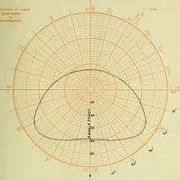 An illustration from Investigation and proposed change of the lighting facilities of the Urbana Presbyterian Church (1911)