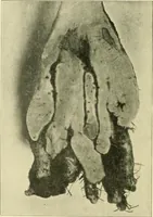 An illustration from Jahrbuch der hamburgischen Wissenschaftlichen Anstalten (1883)