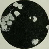 An illustration from Journal (1917)