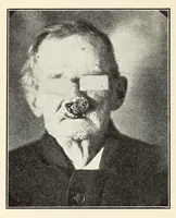 An illustration from The Journal of roentgenology (1918)