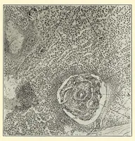 An illustration from The Journal of roentgenology (1918)