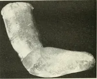 An illustration from Katalogos tou Mouseiou Lykosouras (1911)