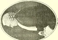 Picture 32 of 39 from Kay's Edinburgh portraits : a series of anecdotal biographies chiefly of Scotchmen (1885), leaf 255