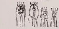 An illustration from Knitting and crochet. A guide to the use of the needle and the hook .. (1885)