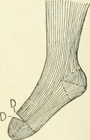 Picture 202 of 271 from Knitting; a manual of practical instruction in the mechanical details of all types of knitting machinery, their operation, adjustment, and care (1909), leaf 275