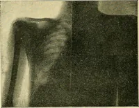 An illustration from Konstruktion, Bau und Betrieb von Funkeninduktoren und deren Anwendung, mit besonderer Berücksichtigung der Röntgenstrahlen-Technik (1904)