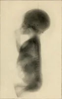 An illustration from Konstruktion, Bau und Betrieb von Funkeninduktoren und deren Anwendung, mit besonderer Berücksichtigung der Röntgenstrahlen-Technik (1904)