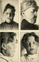 An illustration from Konstruktion, Bau und Betrieb von Funkeninduktoren und deren Anwendung, mit besonderer Berücksichtigung der Röntgenstrahlen-Technik (1904)