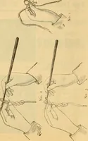 An illustration from Ladies' book of fancy work and instructions for stamping (1884)