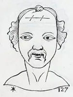 Picture 54 of 91 from La metoposcopie de H. Cardan, medecin milanois : comprise en treize liures, et huit cens figures de la face humaine : a laquelle a esté adjousté, Le traicté des marques naturelles du corps, par Melampus, antien autheur grec : le tout traduit en françois par le sieur C. M. de Laurendiere, docteur en medecine (1658), leaf 103