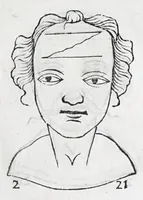 Picture 69 of 91 from La metoposcopie de H. Cardan, medecin milanois : comprise en treize liures, et huit cens figures de la face humaine : a laquelle a esté adjousté, Le traicté des marques naturelles du corps, par Melampus, antien autheur grec : le tout traduit en françois par le sieur C. M. de Laurendiere, docteur en medecine (1658), leaf 169