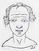 Picture 5 of 91 from La metoposcopie de H. Cardan, medecin milanois : comprise en treize liures, et huit cens figures de la face humaine : a laquelle a esté adjousté, Le traicté des marques naturelles du corps, par Melampus, antien autheur grec : le tout traduit en françois par le sieur C. M. de Laurendiere, docteur en medecine (1658), leaf 27