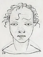 Picture 12 of 91 from La metoposcopie de H. Cardan, medecin milanois : comprise en treize liures, et huit cens figures de la face humaine : a laquelle a esté adjousté, Le traicté des marques naturelles du corps, par Melampus, antien autheur grec : le tout traduit en françois par le sieur C. M. de Laurendiere, docteur en medecine (1658), leaf 35