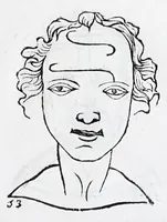 An illustration from La metoposcopie de H. Cardan, medecin milanois : comprise en treize liures, et huit cens figures de la face humaine : a laquelle a esté adjousté, Le traicté des marques naturelles du corps, par Melampus, antien autheur grec : le tout traduit en françois par le sieur C. M. de Laurendiere, docteur en medecine (1658)
