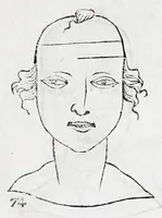 An illustration from La metoposcopie de H. Cardan, medecin milanois : comprise en treize liures, et huit cens figures de la face humaine : a laquelle a esté adjousté, Le traicté des marques naturelles du corps, par Melampus, antien autheur grec : le tout traduit en françois par le sieur C. M. de Laurendiere, docteur en medecine (1658)