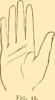An illustration from The language of the hand, being a concise exposition of the principles and practice of the art of reading the hand (1899)
