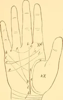 Picture 12 of 13 from The language of the hand, being a concise exposition of the principles and practice of the art of reading the hand (1899), leaf 136