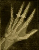 An illustration from La photographie de l'invisible : les rayons X suivi d'un glossaire (1898)