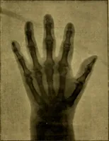 Picture 13 of 23 from La photographie de l'invisible : les rayons X suivi d'un glossaire (1898), leaf 130