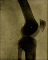 An illustration from La photographie de l'invisible : les rayons X suivi d'un glossaire (1898)