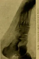 An illustration from La photographie de l'invisible : les rayons X suivi d'un glossaire (1898)