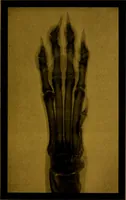 An illustration from La photographie de l'invisible : les rayons X suivi d'un glossaire (1898)