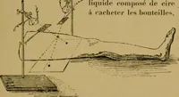 An illustration from La photographie de l'invisible : les rayons X suivi d'un glossaire (1898)