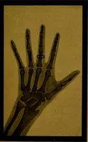 An illustration from La photographie de l'invisible : les rayons X suivi d'un glossaire (1898)