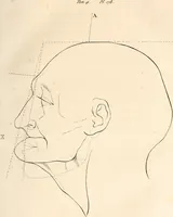 An illustration from L'art de connaitre les hommes par la physionomie (1806)