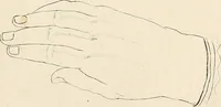 An illustration from L'art de connaitre les hommes par la physionomie (1806)