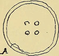 An illustration from La suggestibilité (1900)