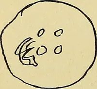 An illustration from La suggestibilité (1900)