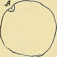 An illustration from La suggestibilité (1900)